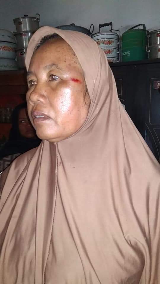 Saleha Terluka Di Pelipis Kiri Akibat Peluru Nyasar Dari Latihan Tempur TNI AL Di Grati