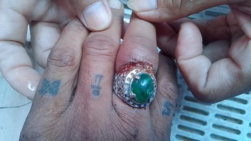 Terjepit Batu Akik Pasca-Kecelakaan, Pria Kuningan Cari Bantuan Ekstra ke Dinas Pemadam Kebakaran